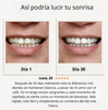 Cepillo Dental™ Dientes radiantes en segundos